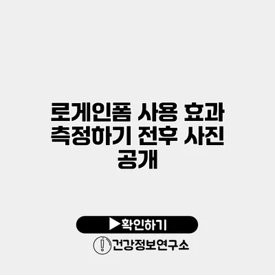 로게인폼 사용 효과 측정하기 전후 사진 공개