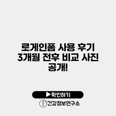 로게인폼 사용 후기 3개월 전후 비교 사진 공개!